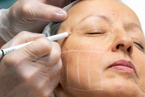 CryoPen: 5 Skin Concerns It May Be Used to Treat 4 What should you ask before having CryoPen treatment Newport?